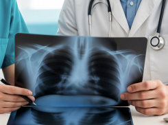 В Воронежской области рекордно снизилось число больных туберкулезом