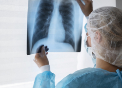 В феврале в сёла Таловского района приедет передвижной флюорограф