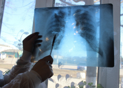 В августе в сёла Аннинского и Таловского районов приедет передвижной флюорограф