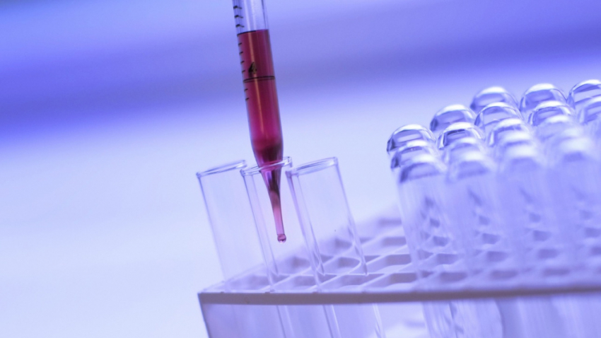 В Воронежской области сибирскую язву заподозрили у 15-летнего мальчика